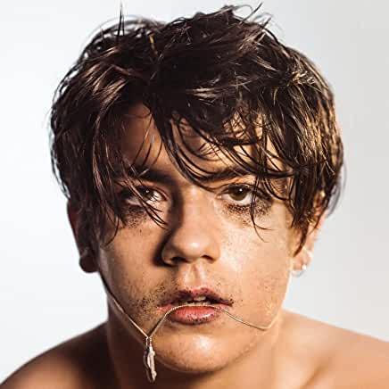 Declan McKenna- What Do You Think About The Car? (Clear/Yellow Vinyl) - VINYL